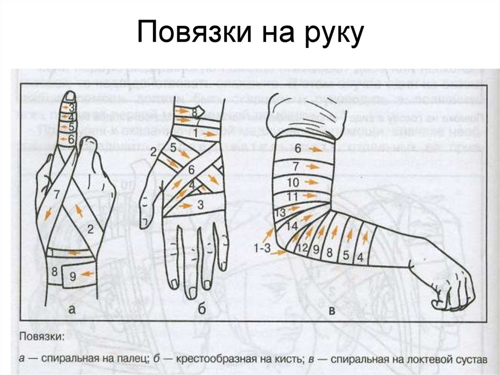 Нарисовать повязку на руку