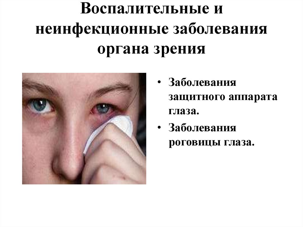 Группы заболеваний глаз. Заболевания органов зрения. Патологии органов зрения. Воспалительные заболевания органов зрения. Заболевания глаз список.