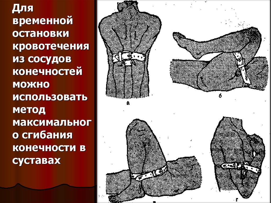 Для остановки кровотечения используют. Конспект по ОБЖ первая помощь пострадавшим и её значение. Первая медицинская помощь пострадавшим и её значение ОБЖ 8. Первая помощь пострадавшим и ее значение ОБЖ 8 класс. Первая медицинская помощь и её значение ОБЖ 8.