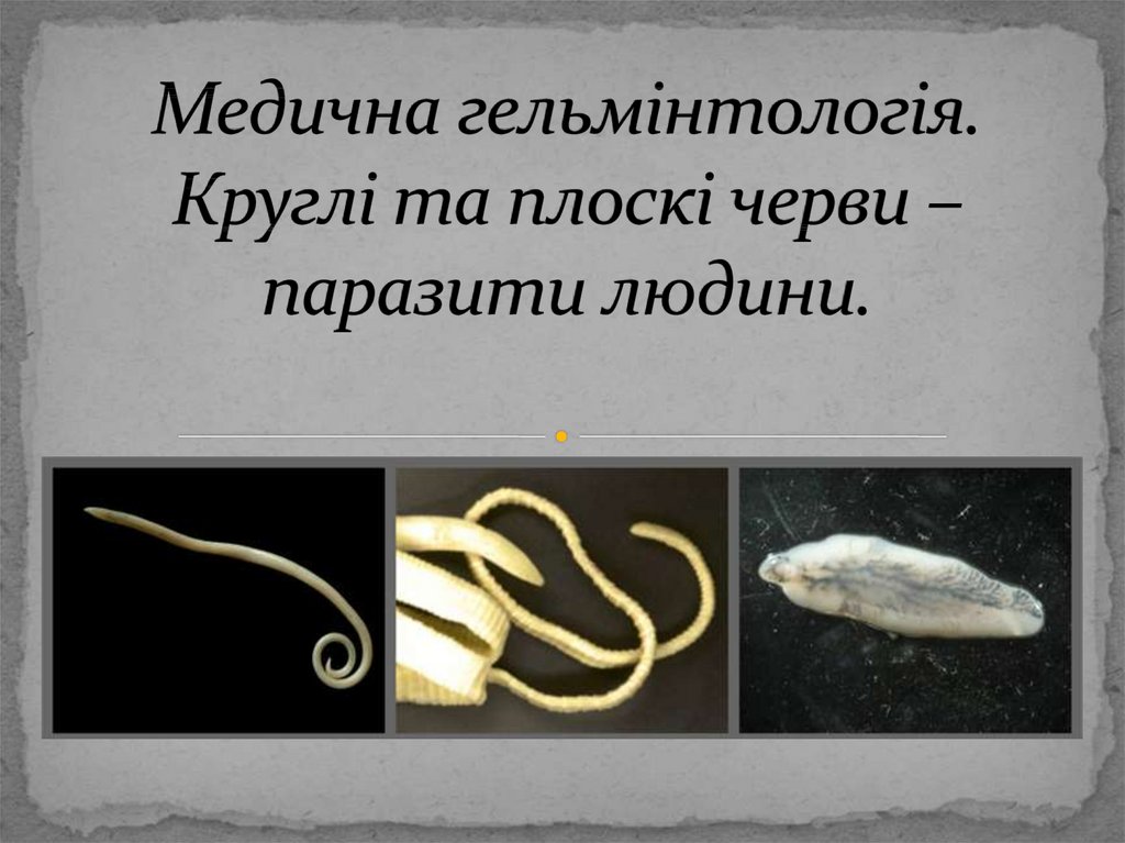 Медична гельмінтологія. Круглі та плоскі черви –паразити людини.