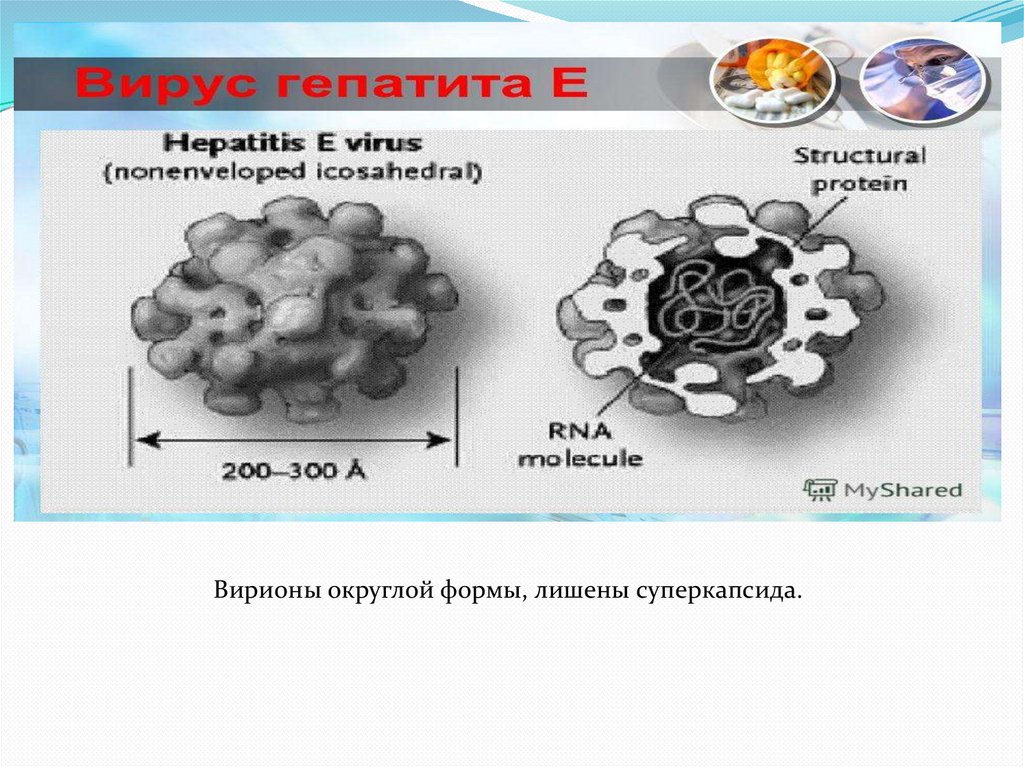 Гепатит е презентация