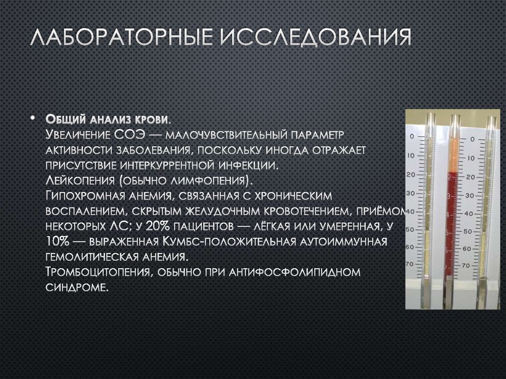 Анализ заболевания. Анализы на системные заболевания. Системные заболевания по анализу крови. Какие анализы при системных заболеваниях. Выявление системные заболевания по анализу крови-.