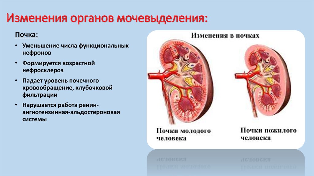 Изменение почек. Изменения мочевыделительной системы в старческом возрасте. Возрастные изменения почек. Возрастные изменения органов мочевыделительной системы. Мочевыделительная система у пожилых людей.