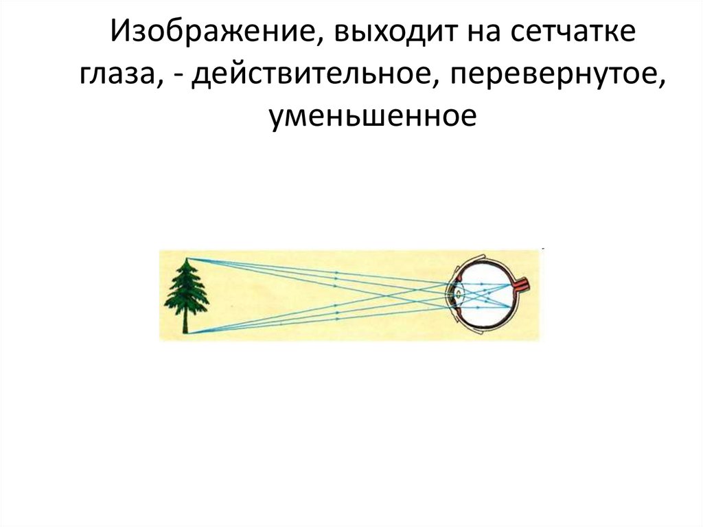 Изображение на сетчатке глаза мнимое или действительное изображение