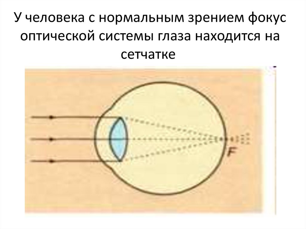 Нормальный глаз схема. Оптическая система нормального глаза. Изображение на сетчатке глаза. Фокус оптической системы глаза. Оптическая схема глаза человека.