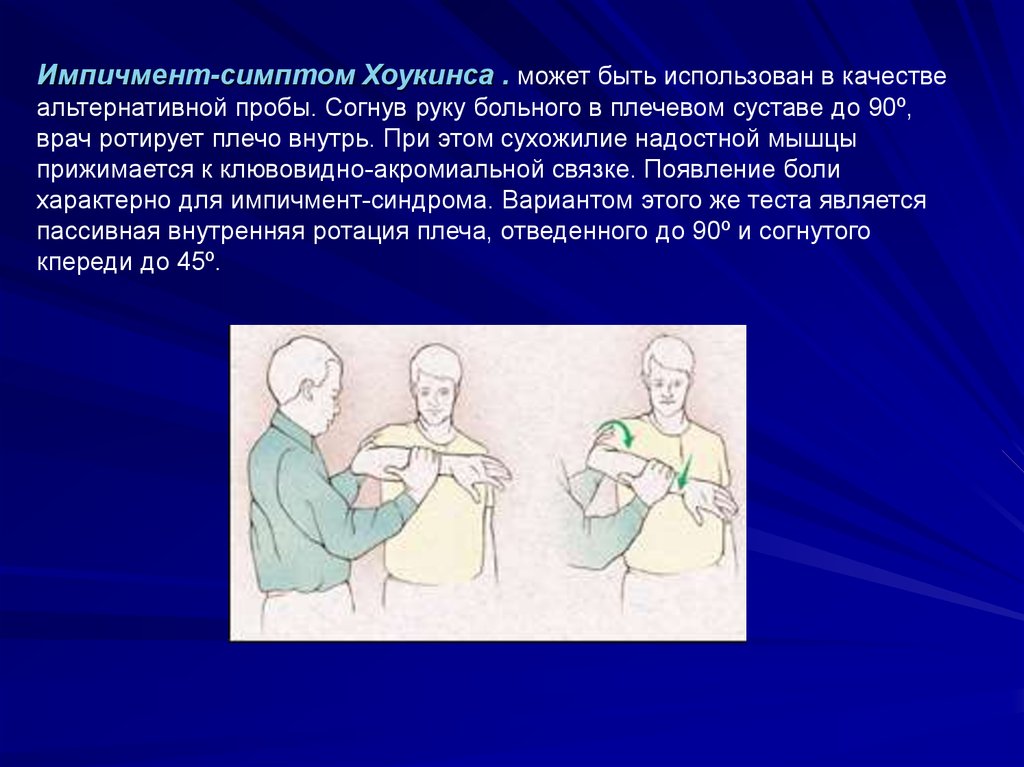 Импичмент плечевого сустава. Симптом Хоукинса. Импичмент плечевого сустава тесты. Лопаточно плечевой Бехтерева.