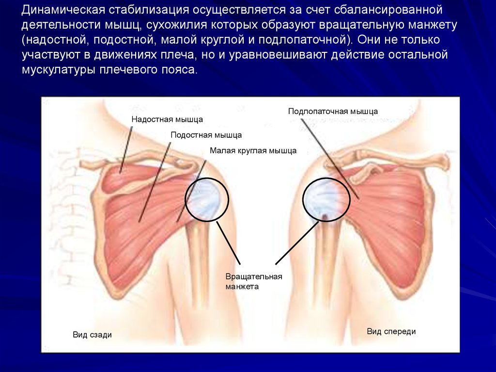 Дегенеративные изменения сухожилия надостной