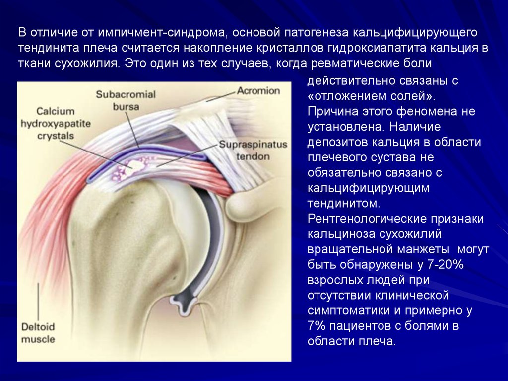 Разрыв надостного сухожилия плечевого сустава лечение. Обызвествление суставной капсулы плечевого сустава. Тендинопатия сухожилия плечевого сустава. Тендинопатия сухожилия надостной мышцы плечевого сустава. Ротаторная манжета плечевого сустава анатомия.