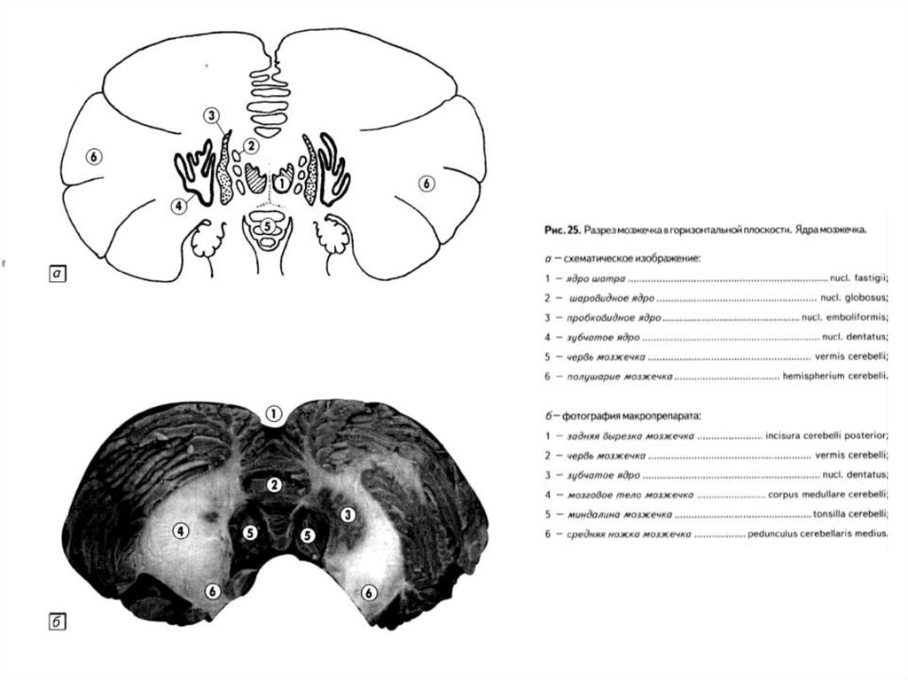 Мозжечок на кт. Анатомия мозжечка кт. Красное ядро мозжечка. Ножки мозжечка анатомия кт. Зубчатые ядра мозжечка мрт.