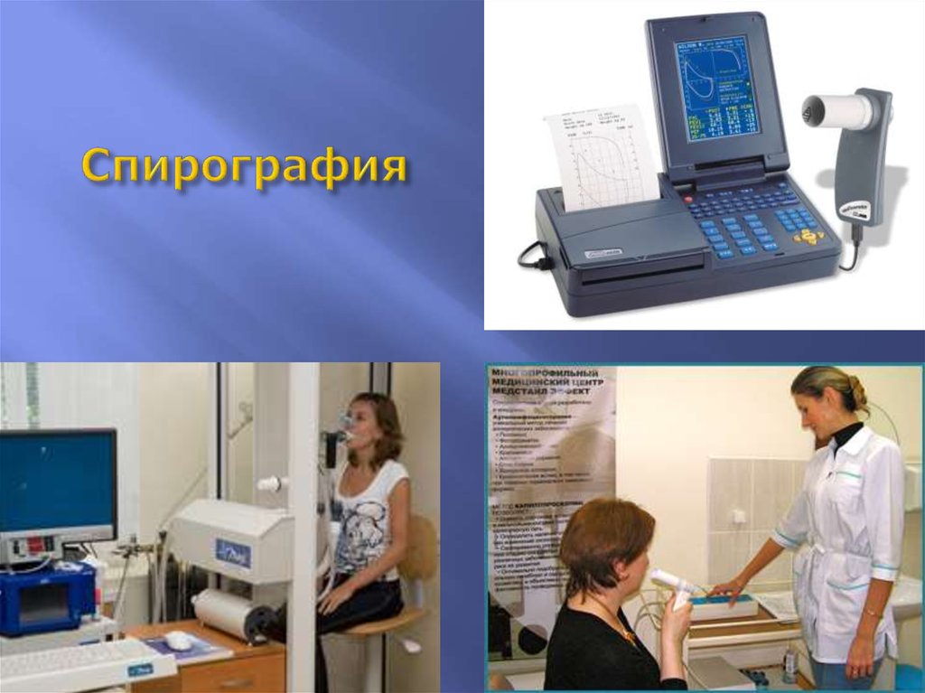 Спирография