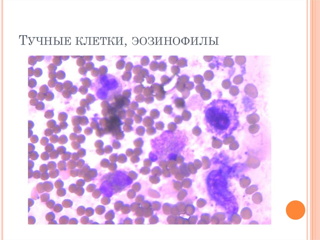 Тучные клетки это. Тучные клетки и эозинофилы. Тучные клетки цитология. Клетка эозинофилы. Эозинофилы, базофилы и тучные клетки.