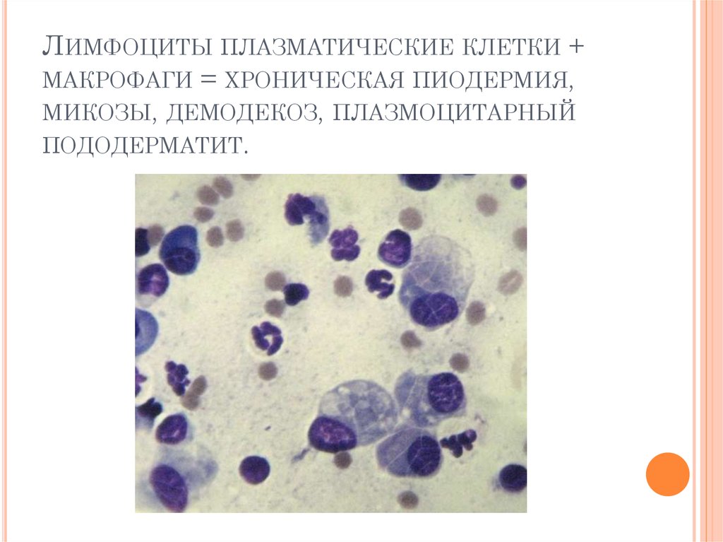 Плазматические клетки ребенка
