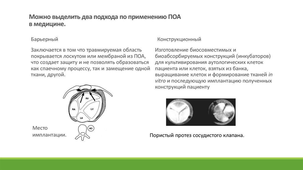 Можно выделить два подхода по применению ПОА в медицине.