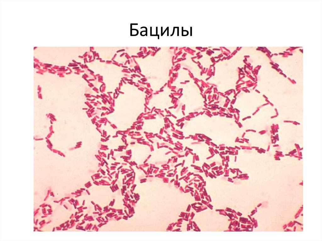 Окраска водным фуксином рисунок