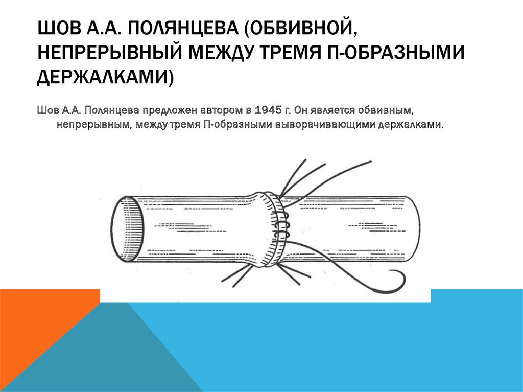 Сосудистый шов история