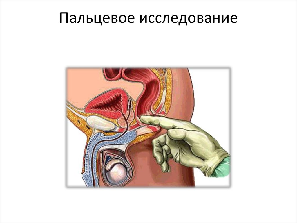 Пальцевое исследование