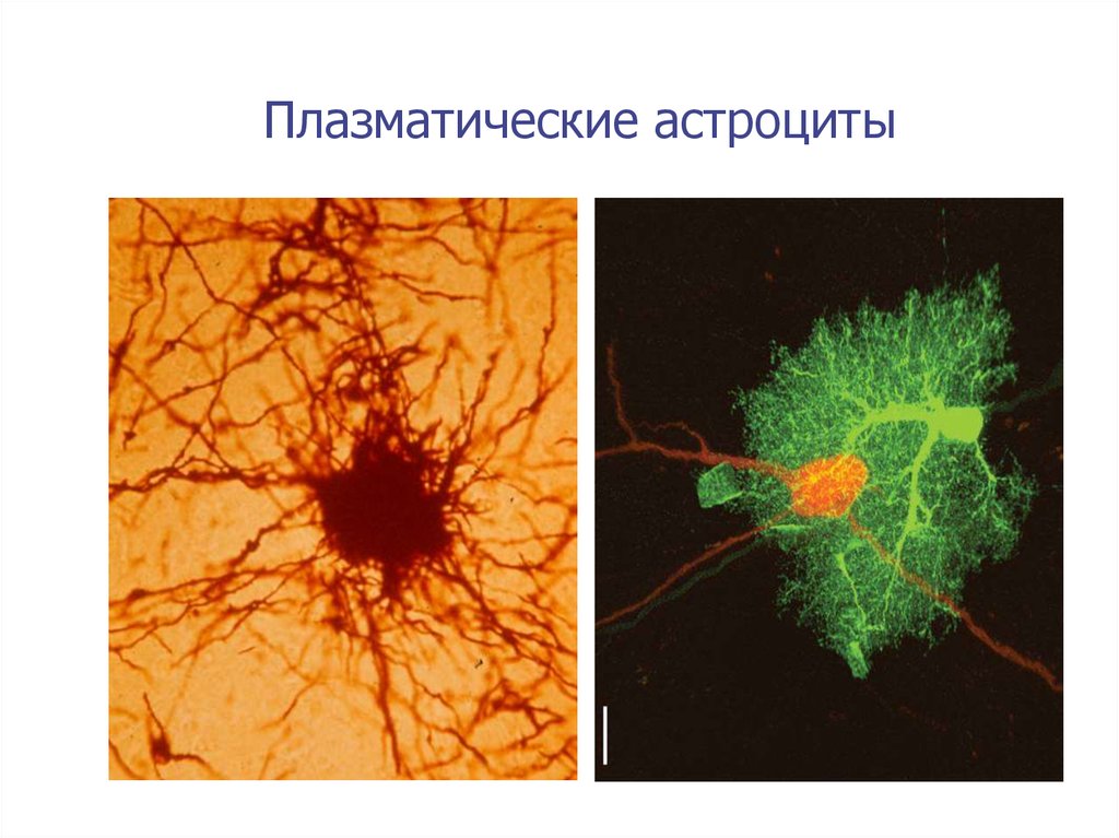 Астроциты. Плазматические астроциты. Астроциты гистология. Протоплазматические астроциты гистология. Волокнистые астроциты гистология.