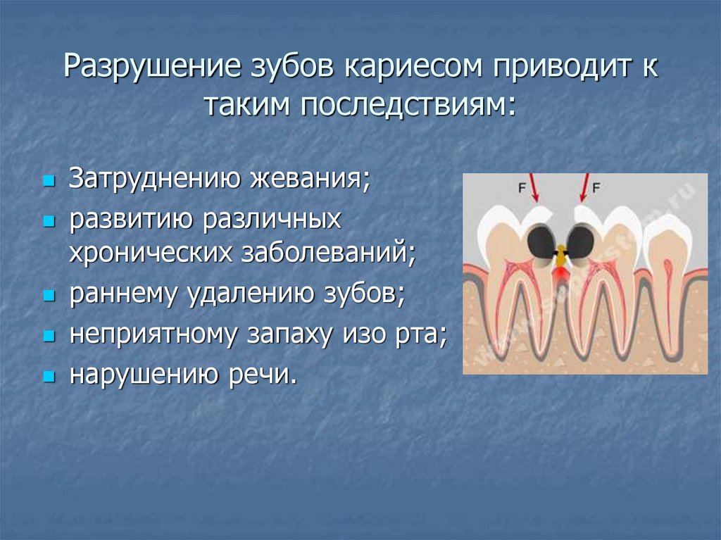 Зубов причины. Причины развития кариеса. Кариозное разрушение зубов. Кариес зубов причины возникновения.