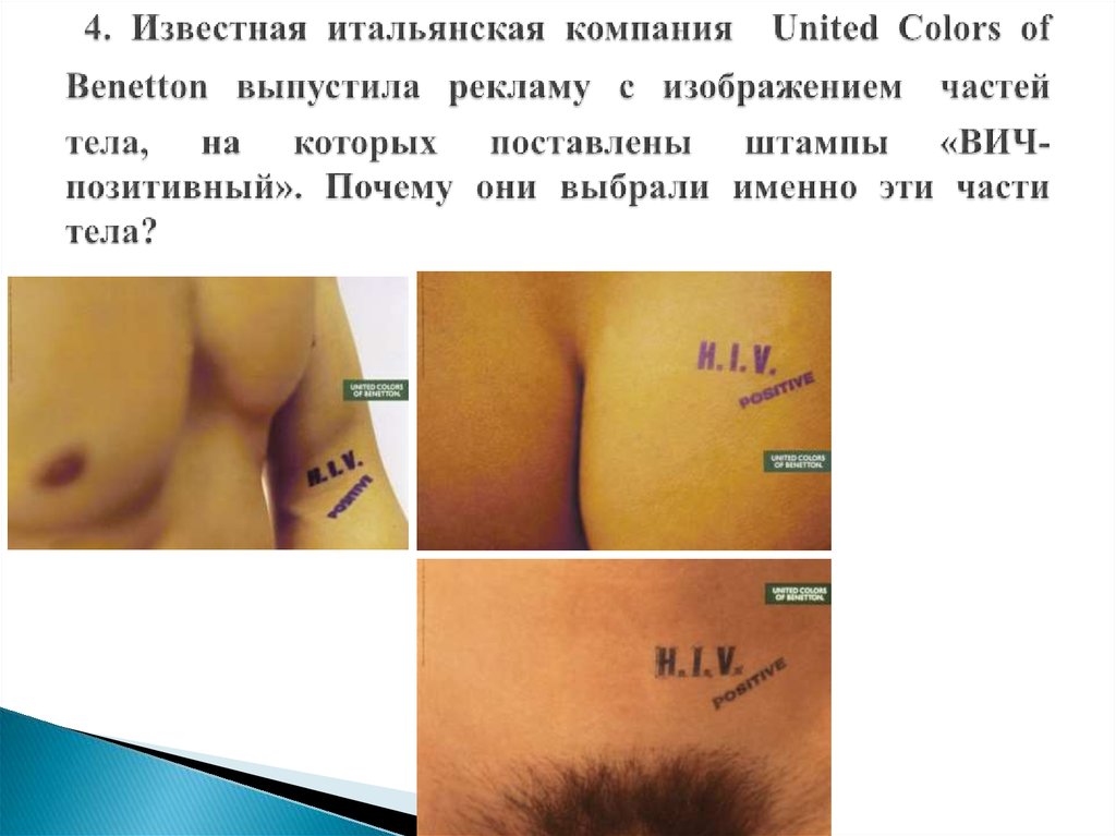  4. Известная итальянская компания United Colors of Benetton выпустила рекламу с изображением частей тела, на которых