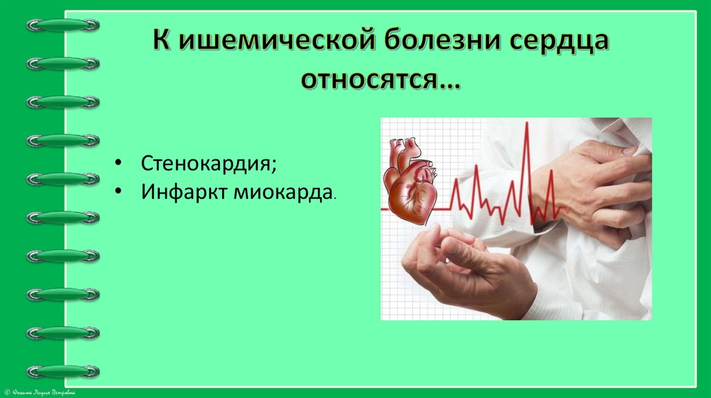 К ишемической болезни сердца относятся…