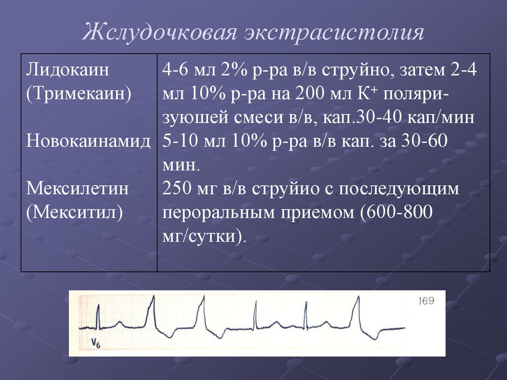 Экстрасистолия лечение. Экстрасистола с блокадой. Лидокаин при желудочковой экстрасистолии. Аритмии блокады. Лидокаин желудочковая аритмия.