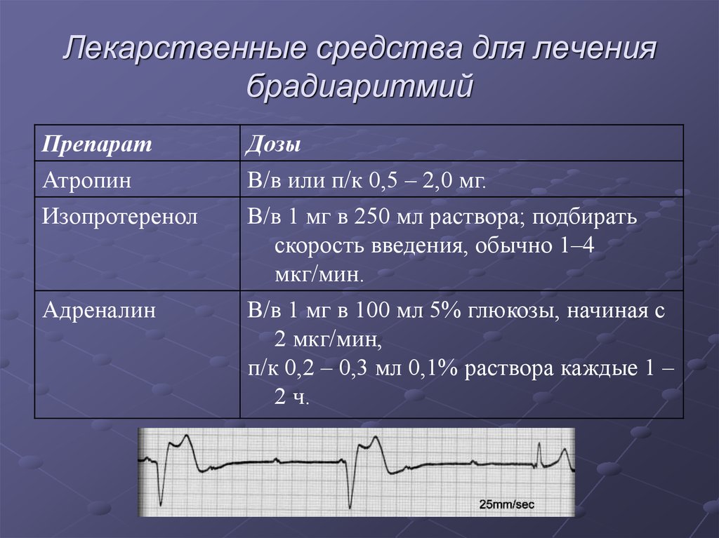 Брадиаритмия. Препараты устраняющие брадиаритмию. Таблетки при брадиаритмии. Брадиаритмия медикаментозная. Средства применяемые при брадиаритмиях и блокадах сердца.