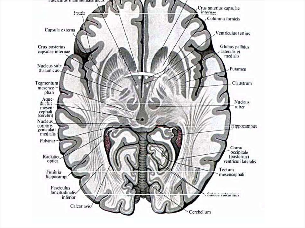 Поперечный разрез головного мозга рисунок с подписями