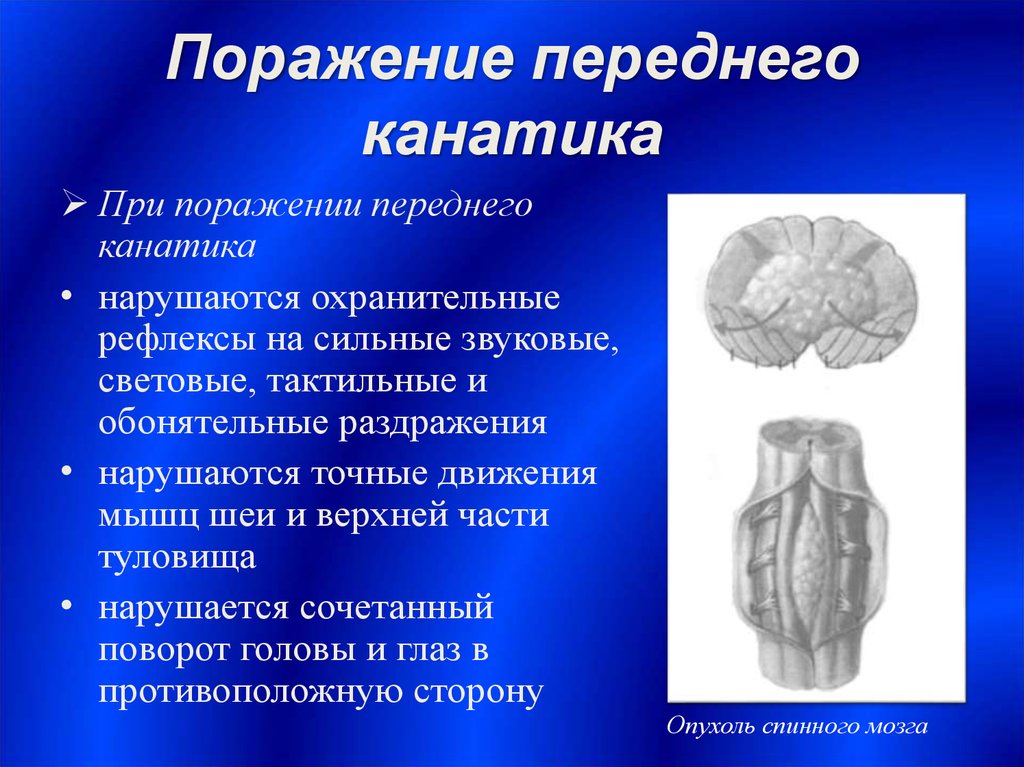 Канатики мозга. Поражение переднего канатика спинного мозга. В передних канатиках спинного мозга. Признаки поражения бокового канатика спинного мозга:. Поражение передних канатиков спинного мозга.