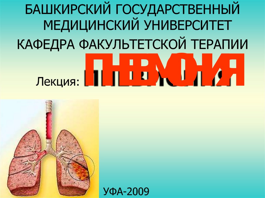 Скачать презентацию на тему пневмония бесплатно по терапии thumbnail