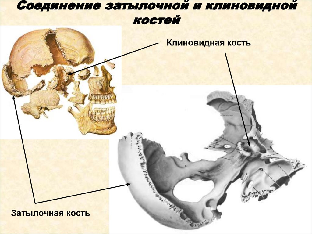 Выйная линия затылочной кости в картинках