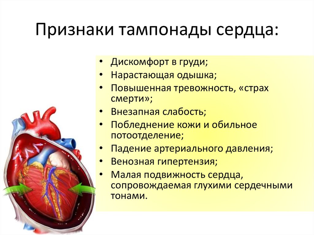 Является причиной сердечных заболеваний. Проявления тампонады сердца. Признаки тампонады сердца. Клинические признаки тампонады сердца. Критерии тампонады сердца.