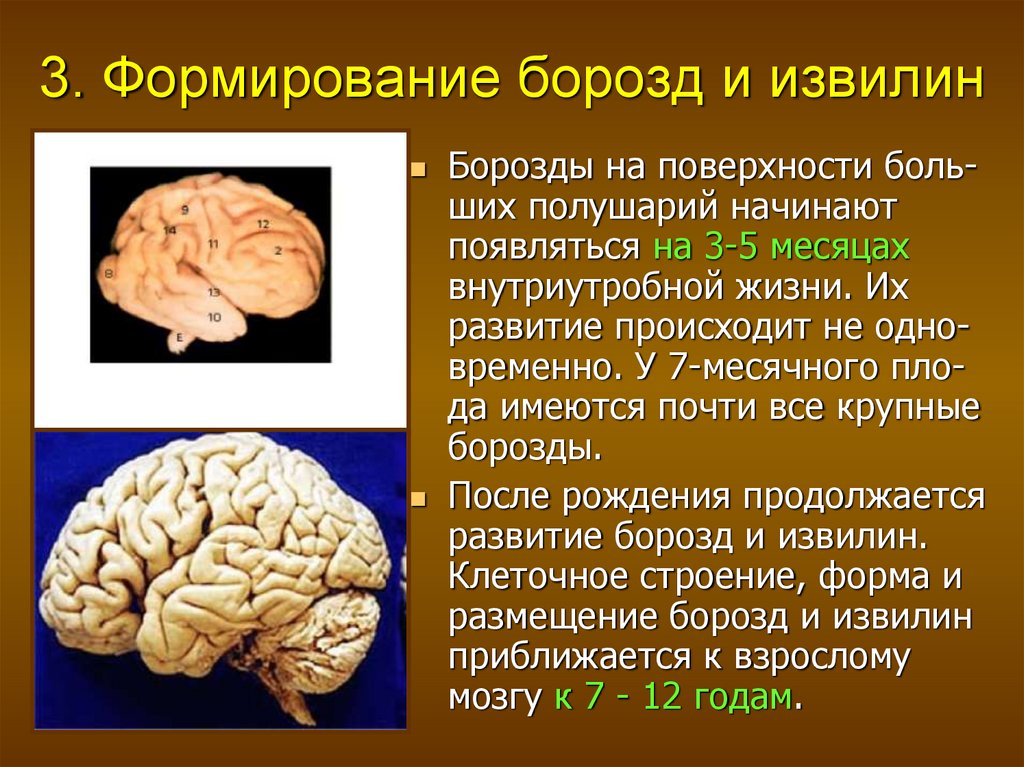 Возрастные изменения мозга. Извилины мозга. Мозг человека извилины и борозды. Количество борозд в головном мозге. Борозды и извилины коры больших полушарий.