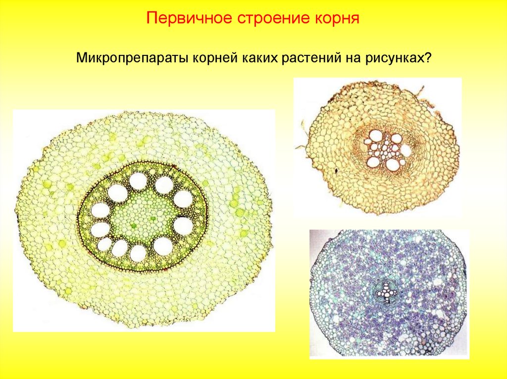 Первичное строение. Первичное строение корня ириса. Первичное строение корня микропрепарат. Микропрепарат стебель однодольного растения. Первичное строение корня ириса на поперечном срезе.