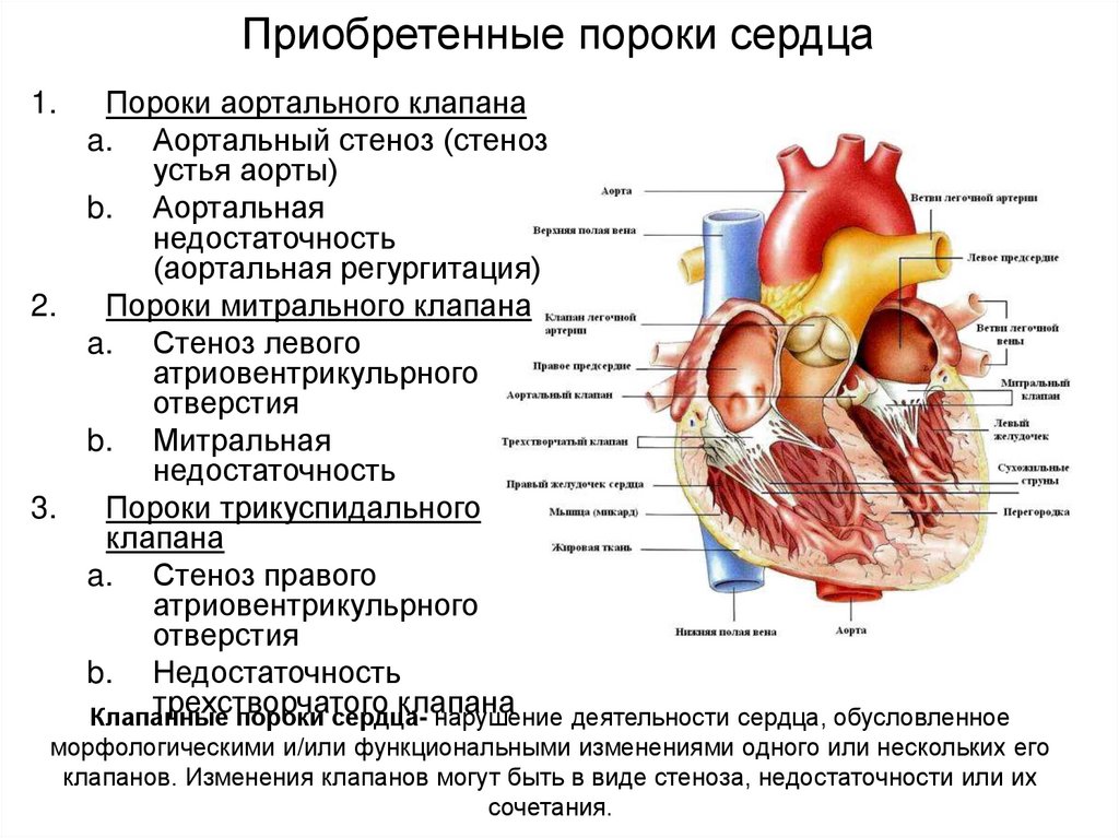 Приобретенные пороки сердца факультетская терапия презентация