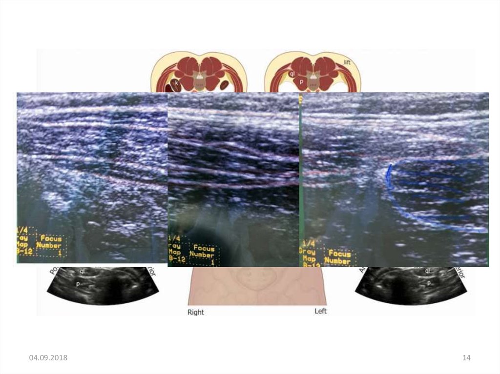 Ультразвуковая анатомия