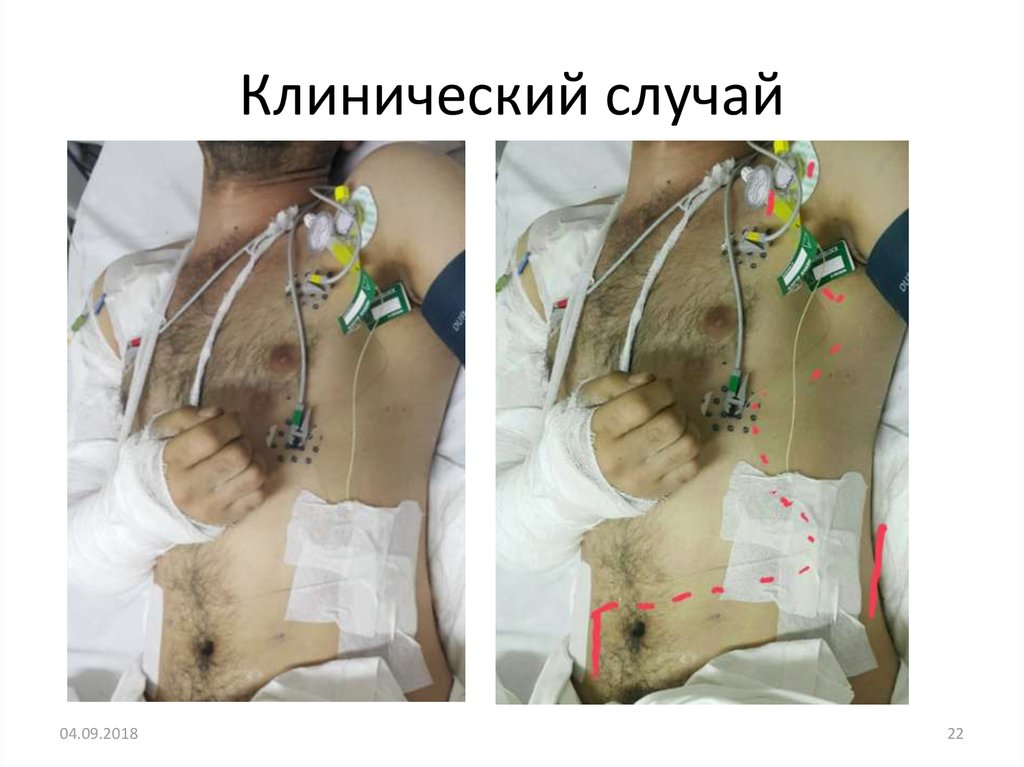 Клинический случай