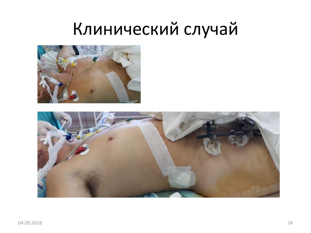 Клинический случай