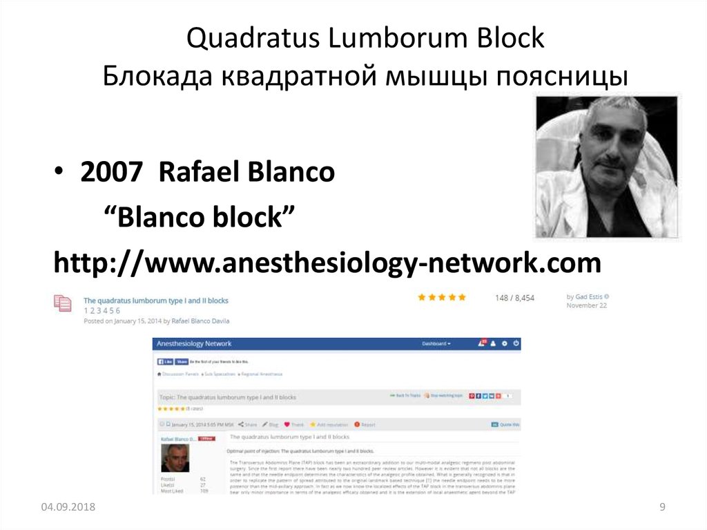 Quadratus Lumborum Block Блокада квадратной мышцы поясницы