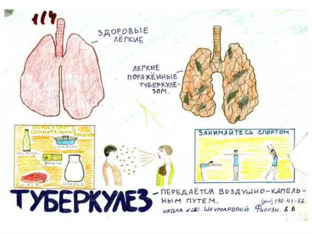 Туберкулез 5 класс. Здоровые легкие и туберкулез. Здоровое легкое и туберкулёз.