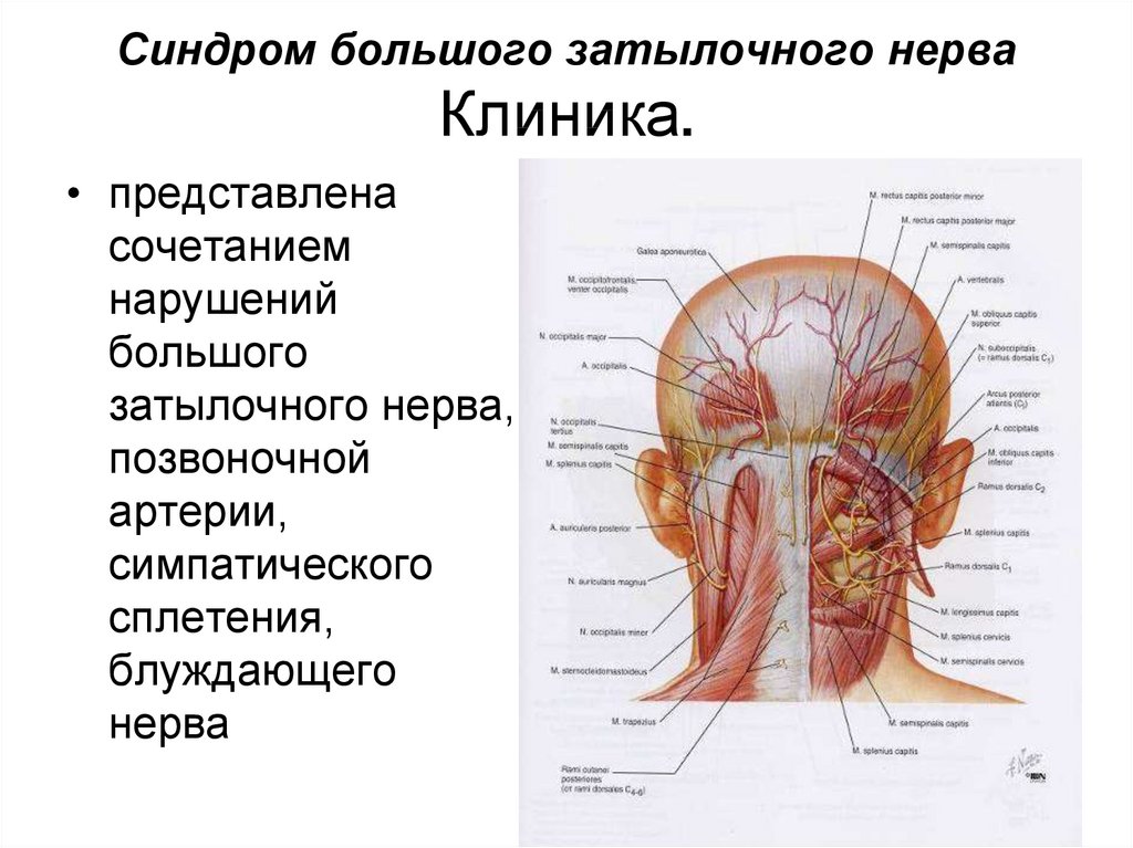 Причины боли у основания черепа. Подзатылочный нерв анатомия.
