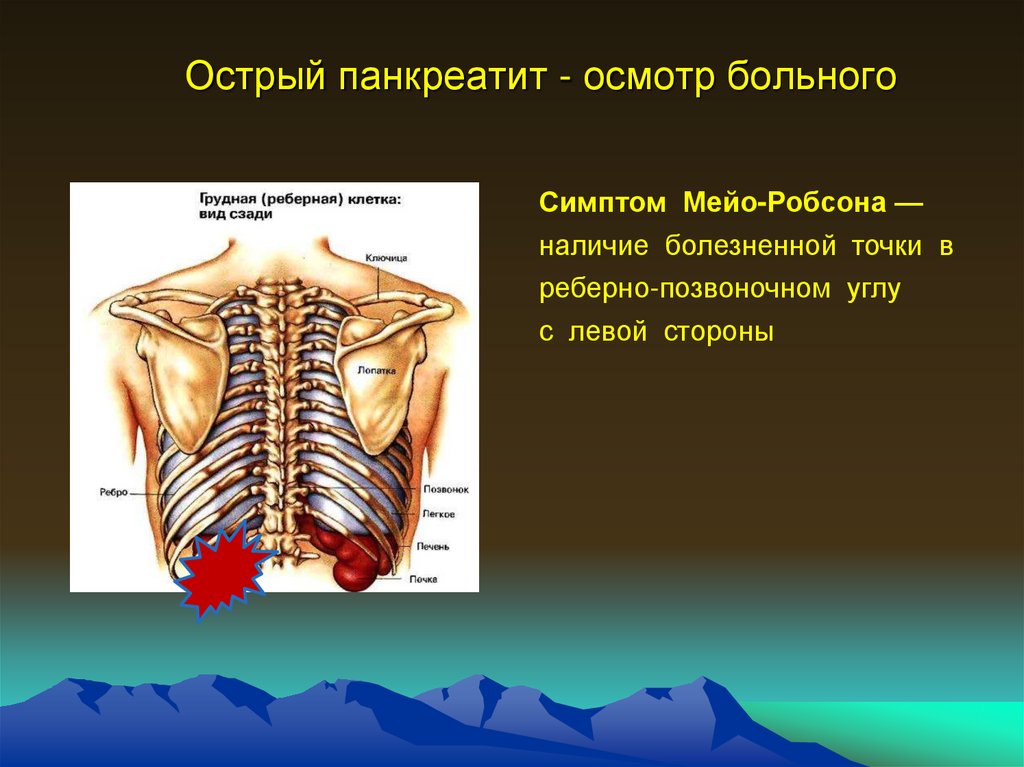 Симптом керте