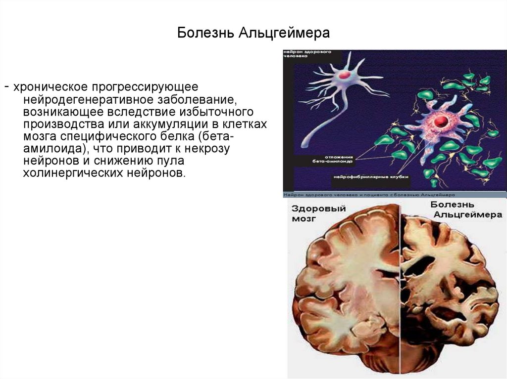 Скорость нейронов в мозге