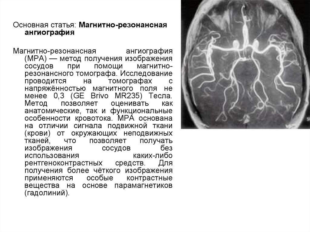 Контрастное вещество. Ангиография контрастное вещество. Магнитно-резонансные контрастные вещества. Контрастные вещества для мрт. Парамагнитные контрастные вещества.