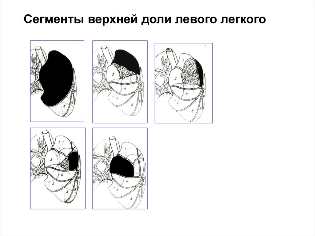 Сегменты верхней доли левого легкого. Сегменты верхней доли правого легкого. Сегменты средней доли правого легкого.