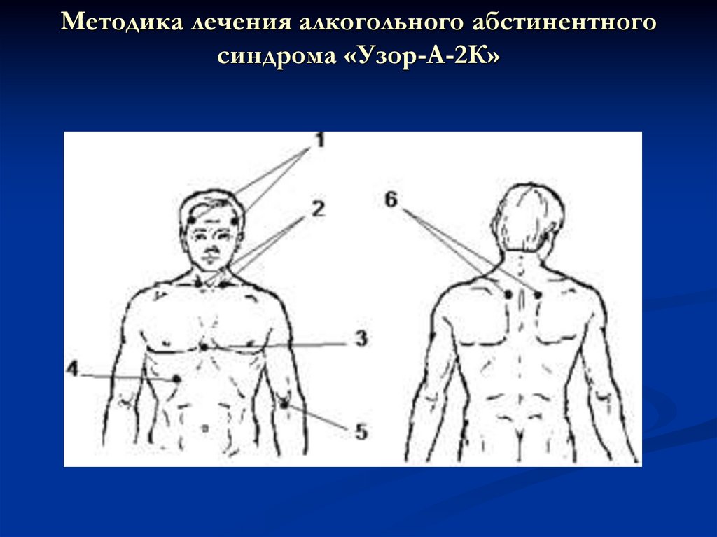 Для купирования болевого синдрома применяют инфракрасную лазеротерапию по следующей схеме