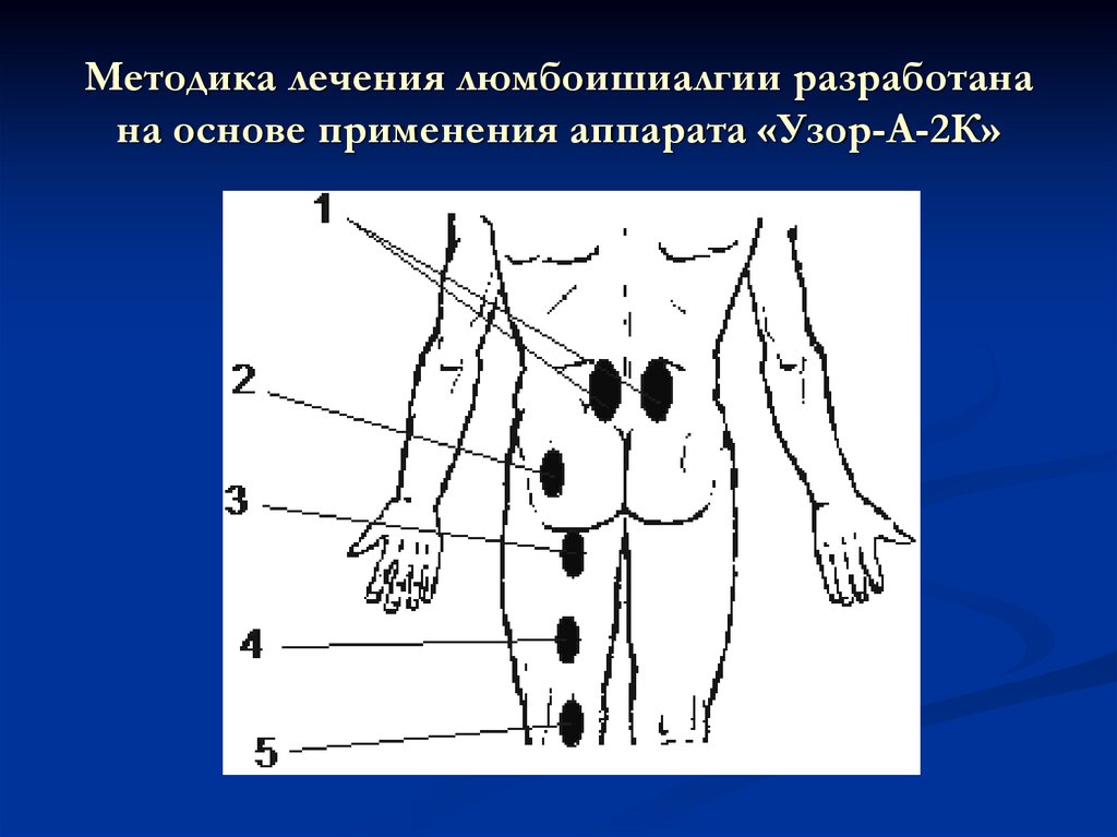 Методика точки. Методики лазеротерапии. Основные методики лазеротерапии. Лазеротерапия узор методики. Методика выполнения лазеротерапии на рисунке.