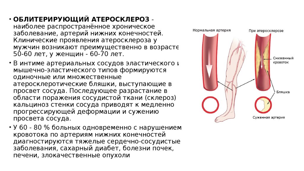 Тромбоз артерии мкб 10. Облитерирующий атеросклероз нижних конечностей. Облитерирующий атеросклероз артерий нижних конечностей пациенты. Облитерирующий атеросклероз артерий нижних конечностей клиника. Осложнение атеросклероза бедренных артерий.