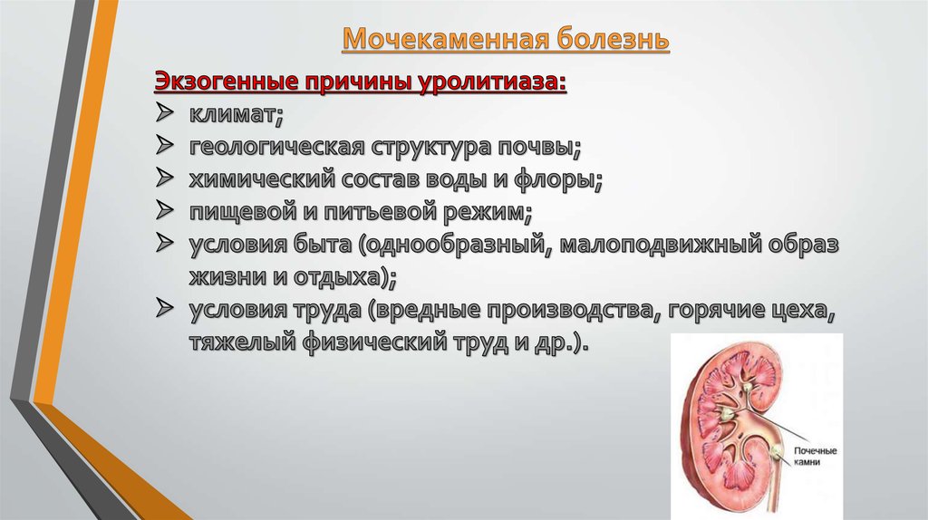 Классификация мочекаменной болезни