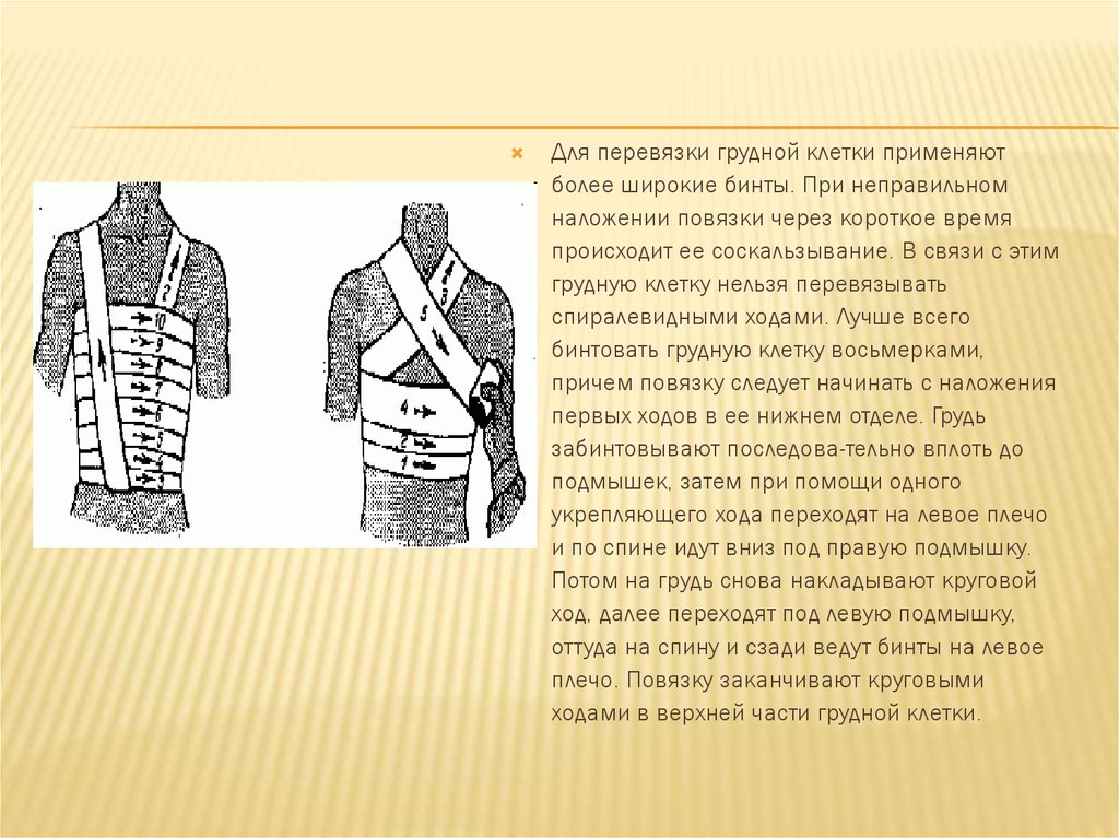Звук перевязки. Бинтовать грудную клетку. Перевязка грудной клетки. Наложение повязки на грудную клетку. Перевязка грудной клетки алгоритм.