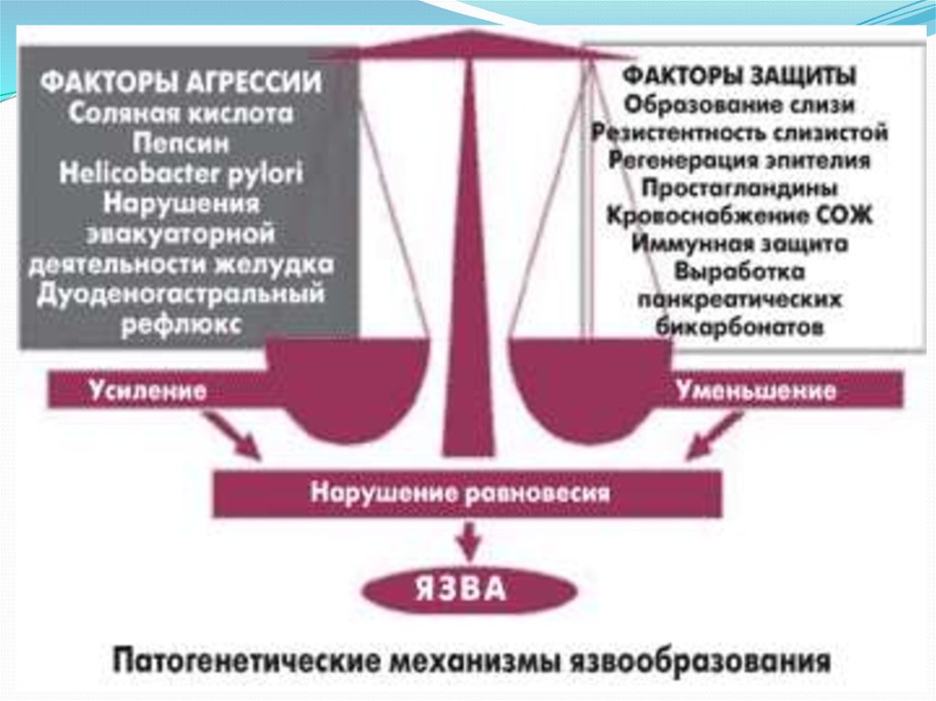 Этиология и патогенез язвенной болезни желудка презентация